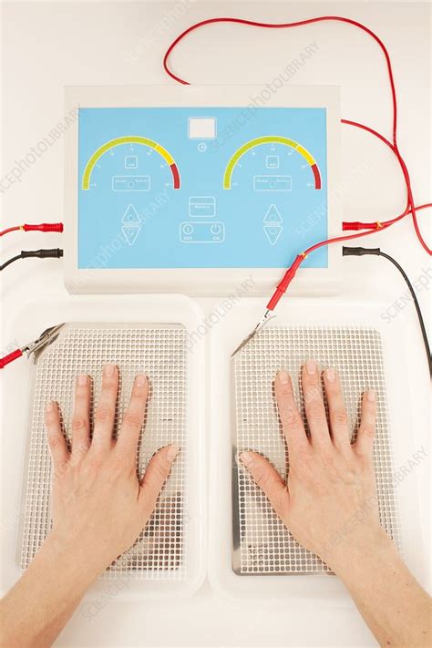 Iontophoresis For Excess Sweating Stock Image F0040765 Science