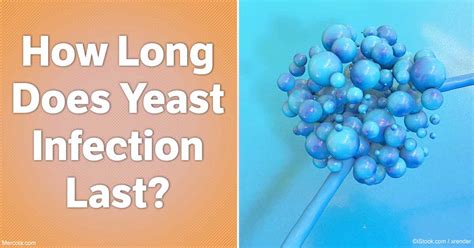 How Long Does A Yeast Infection Last