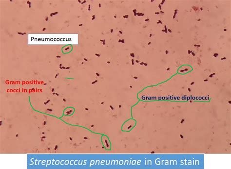 Streptococcus Pneumoniae Colony Morphology