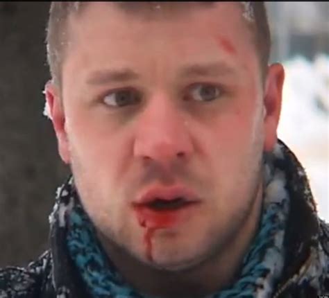 Artem Kalinin Russian Gay Activist Beaten By Local Neo Nazi On Camera Graphic Video Huffpost