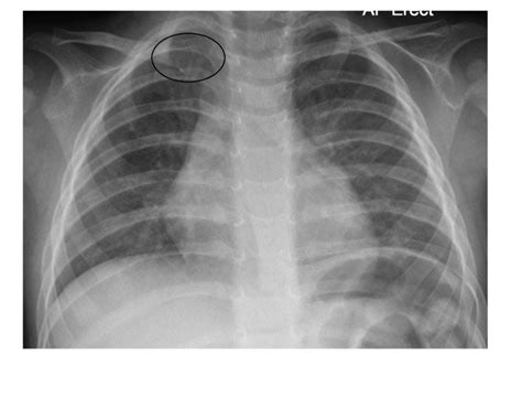 Imaging Case Of The Week 187 Answer Emergucate
