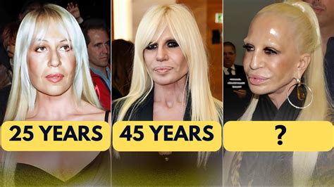 5 Celebrities With Terrible Plastic Surgery YouTube