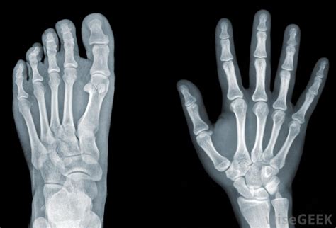 They see straight through clothing, flesh and even metal thanks to some very cool scientific principles at work. How do X-Rays Work? (with pictures)
