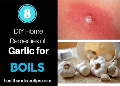 How To Use Garlic For Boils To Get Rid Of Boils Quickly Top 8 Ways Healthandcaretips