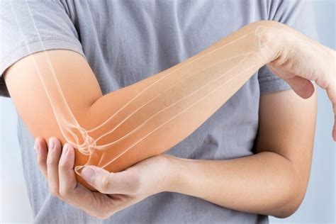 Think You Have Golfers Elbow Here Are The Symptoms And What You Can