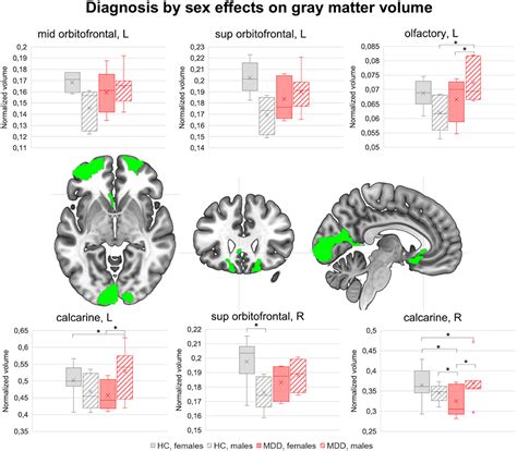 Frontiers Sexual Dimorphism In The Brain Correlates Of Adult Onset Depression A Pilot