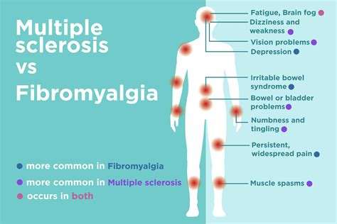 What Symptoms Are Different Between Fibro And Ms Rfibromyalgia