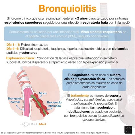 Bronquiolitis Spotlightmed Spotlightmedicine Medschool Medlife