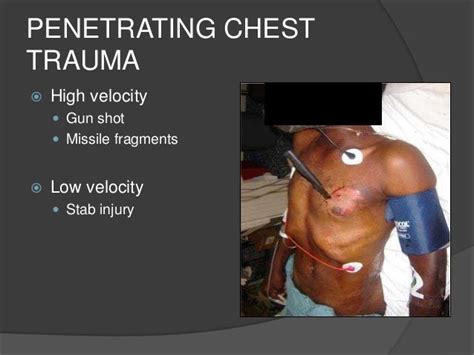 Chest Trauma