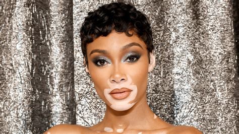 Winnie Harlow Sizzles In A Glamorous Strappy Black Swimsuit For Latest