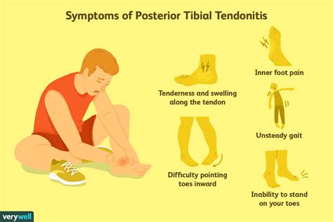 Tibialis Posterior Tendonitis Treatment