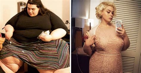 Before And After Photos Of People With Dramatic Weight Loss Gag