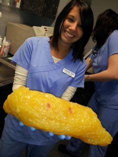 Kilogram results appear plus grams remainder. And here's what 50 lbs of fat looks like…. | Workout ...