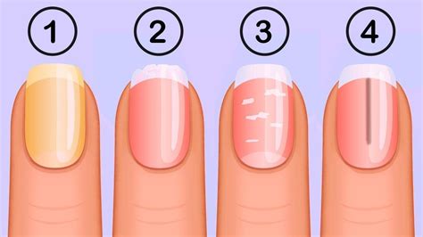 7 Things That Your Nails Say About Your Health How To Take Care Of Your Nails Remedies One