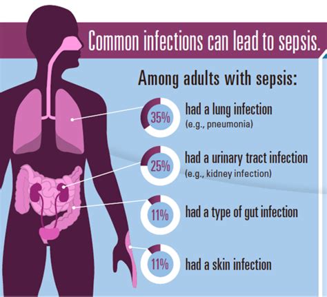 Lets Learn Disease Symptoms Test And Drug Together Sepsis And Septic