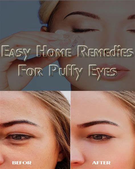 How To Get Rid Of Puffy Under Eyes Permanently Puffy Eyes Remedy