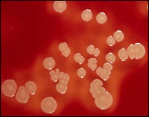 Staphylococcus Aureus Fundación Io