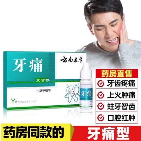 Yunnan Herb Toothache Medicine Toothache Special Effect Anti Inflammatory Agent Nerve Fire