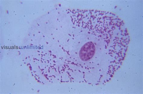 Check spelling or type a new query. Cheek cell with prominent nucleus and bacteria on cells ...