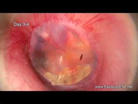 Often abscesses are already ruptured by the time the pet is evaluated by a veterinarian. Ear Infections