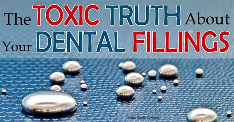 Mercury fillings require the removal of the middle third of the tooth. Toxic Dental Fillings With Mercury Can Cause Over 30 ...