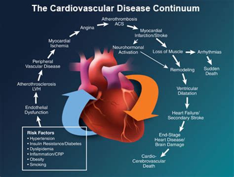 • congestive heart failure at the massive destruction of. What is Cardiovascular Disease? | Health Life Media