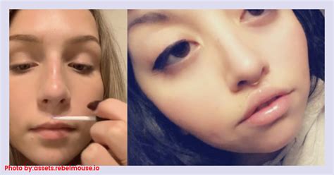 Tiktok Users Super Gluing Their Lips Goes Viral Social News Xyz