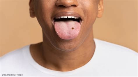 Spiritual Meaning Of Black Spots On The Tongue Spiritual Details