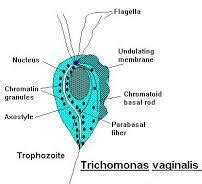 Trichomonas Vaginalis Jdsk