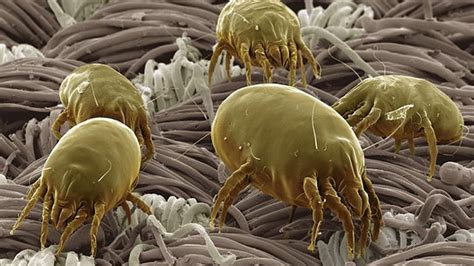 Meet One Of Ten Species Of Dust Mite Known To Live In Carpeting Usa
