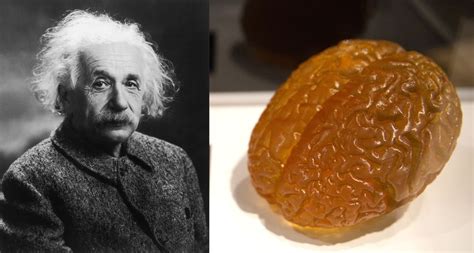 Where Is Einsteins Brain Live Science