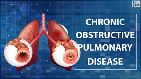 Chronic Obstructive Pulmonary Disease Copd Youtube
