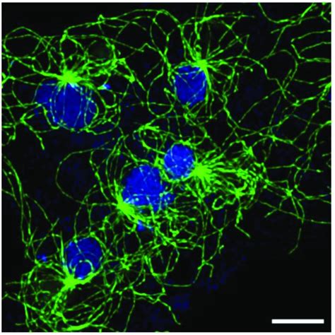 Multinucleated Cell Selected Area Of An Exceptionally Large Flattened