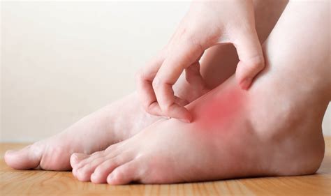 Symptoms Of Plantar Fasciitis And What To Do About It Nd2a Content