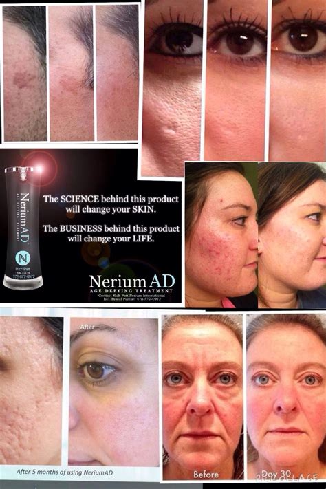 Nerium Ad Is One Bottle For Fine Lines And Wrinkles Discoloration