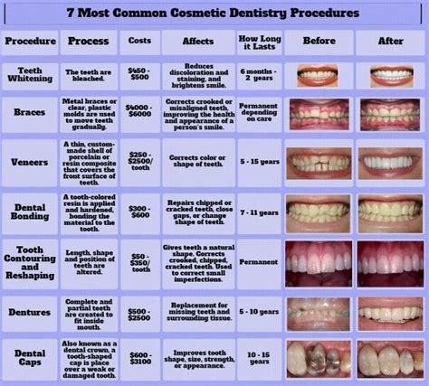 Discover Dentists Common Dental Procedures