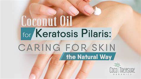 Coconut Oil For Keratosis Pilaris Caring For Skin The Nat Flickr