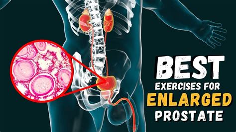 Secret Exercises To Transform Your Prostate Health Bph Youtube