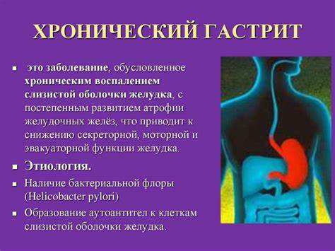 Хронический гастрит симптомы и диета