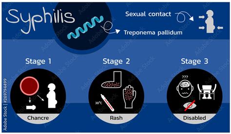 Stages Of Syphilis Chart