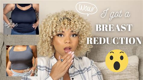 VLOG I Got A Breast Reduction Lift 1 Month Post OP DDD F To D