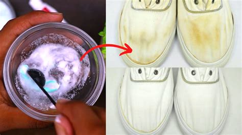 How To Get Rid Of Yellow Stains On White Shoes Museosdelima