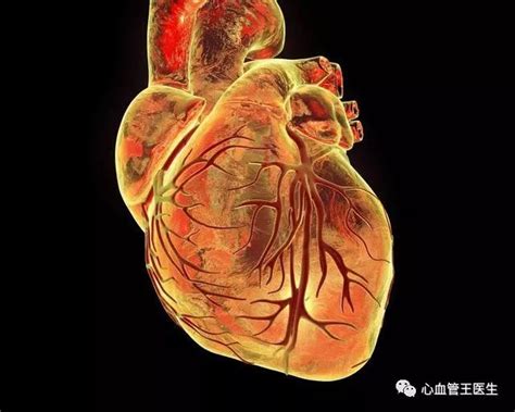心脏功能分四级，心脏衰竭——这个让医生也很头大的疾病心脏功能心衰药物患者 健康界