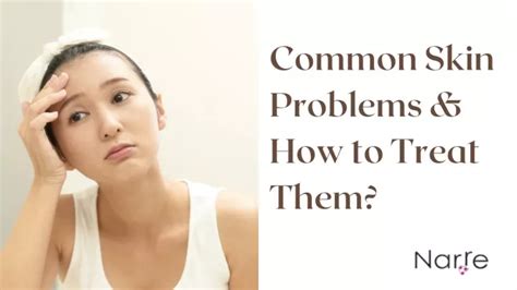 Ppt Common Skin Problems And How To Treat Them Powerpoint Presentation
