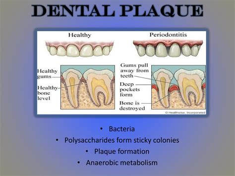 Ppt What Is The Connection Between Anaerobic Metabolism And Dental