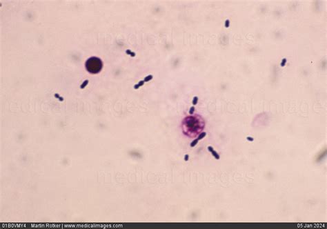 Stock Image Photomicrograph Of Streptococcus Pneumoniae Also Called