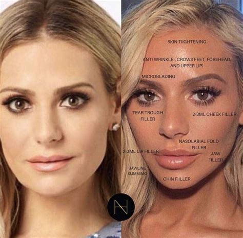 Pinterest Seanabeauty Face Fillers Lip Fillers Cost Facial Fillers