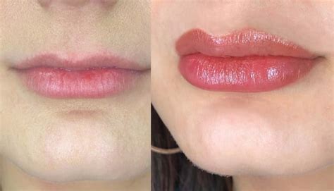 How To Remove Lip Blush Tattoo Christensen Welaidene