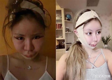16 Year Old Girl Allegedly Undergoes 100 Cosmetic Procedures In 3 Years