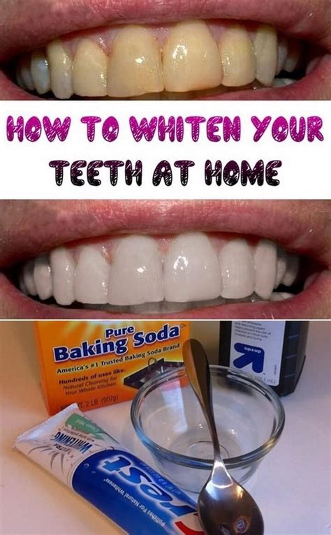 Pin On How To Take Care Oral Health